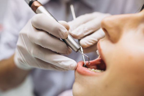 Удаление зуба: основные особенности процедуры, показания